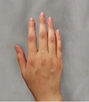 J Skin Stem Cell